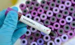 Coronavirus, a Cuneo in arrivo laboratorio per esame tamponi