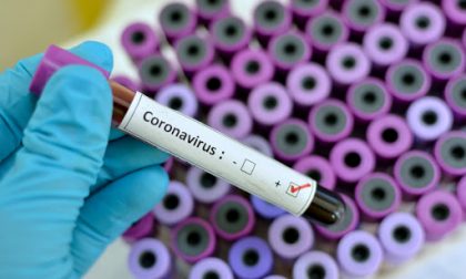 Coronavirus, i  guariti in Piemonte sono oltre 15 mila