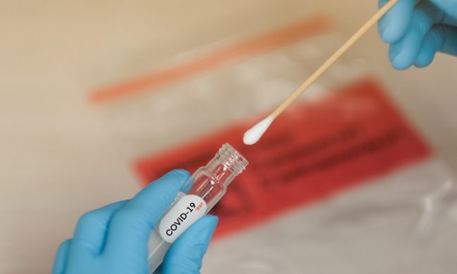 Covid19, primo caso di variante brasiliana in Piemonte